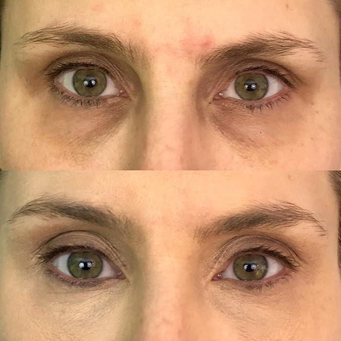 Dermaflage Color Correcting Palette, Color Corrector Concealer for Dark Circles, Redness, Bruises, Dark Spots, by Dermaflage 6.9g/.24oz