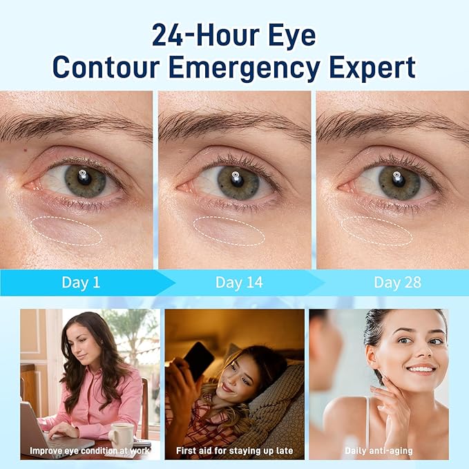 Under Eye Patches for Dark Circles, Eye Patches for Puffy Eyes and Dark Circles, Parches Para Ojeras - Skin Care Deep Hydrating & Firming Eye Treatment