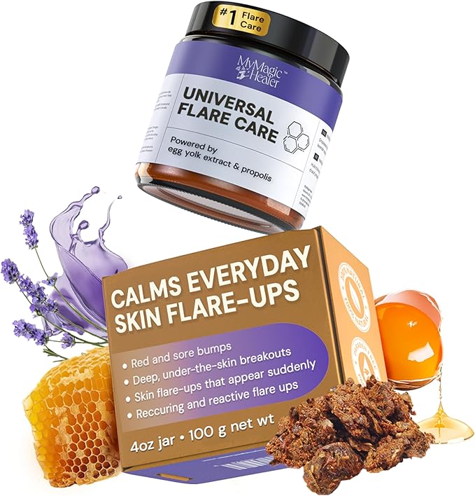 MyMagicHealer Universal Flare Care – Multi-Purpose Solution | Skin Flare-Ups - Hidradenitis Suppurativa, Folliculitis, Boils, Cysts | Anti-Chafing | Irritated Skin Relief w/Propolis & Egg Yolk 4 oz