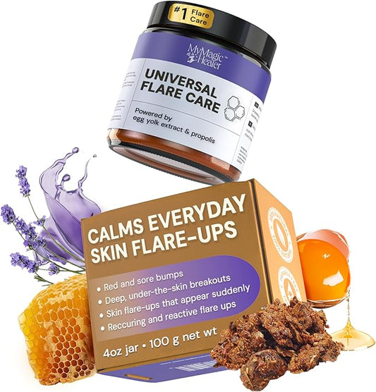 MyMagicHealer Universal Flare Care – Multi-Purpose Solution | Skin Flare-Ups - Hidradenitis Suppurativa, Folliculitis, Boils, Cysts | Anti-Chafing | Irritated Skin Relief w/Propolis & Egg Yolk 4 oz