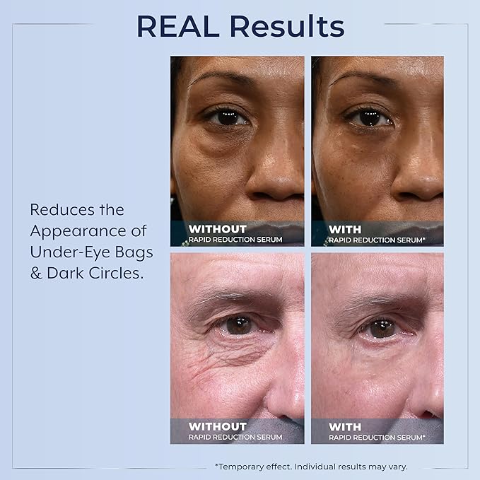 Plexaderm Rapid Reduction Eye Serum - Visibly Reduces Under-Eye Bags, Wrinkles, Dark Circles, Fine Lines & Crow's Feet Instantly, Anti Aging Wrinkle Remover for Face, 3 Full Size Tubes