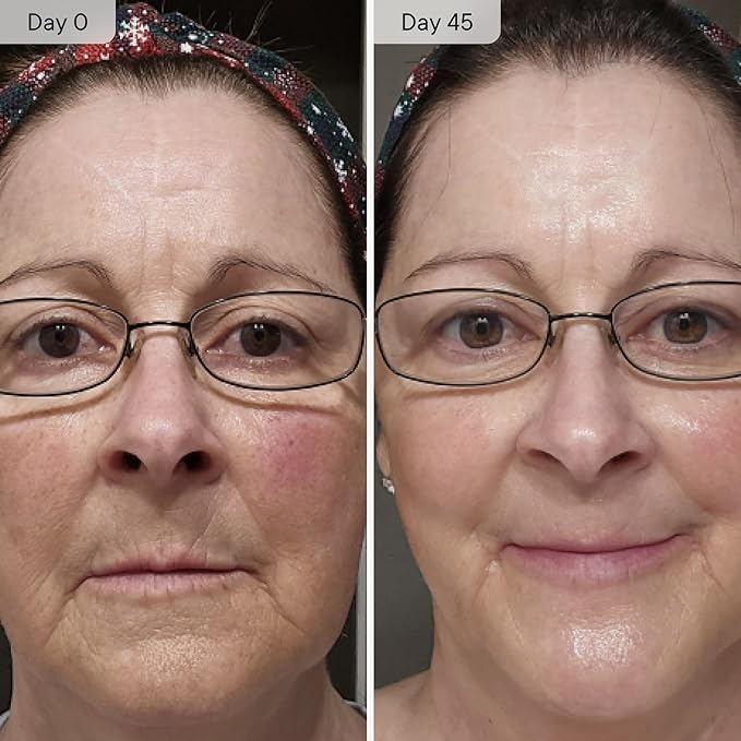 Qure Micro Infusion System for Face & Neck - Facial Moisturizing Essence, Hydrating Serum for All Skin Types, Refreshed Skin - 5-Month Supply