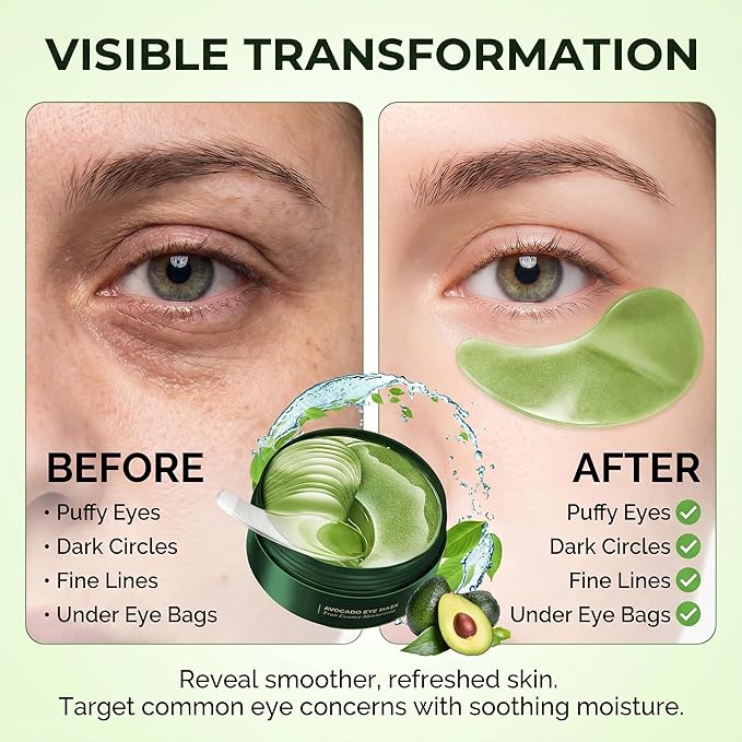 Avocado Eye Mask 60 PCS, Under Eye Patches for Dark Circles and Puffiness, Moisturizing Nourishing Eye Treatment Mask, Improving Eye Skin Dryness, Fine Lines and Wrinkles, Parches para Ojeras