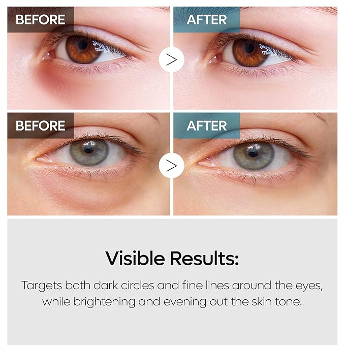 Dr.Melaxin TX Tranexamic Acid Retinalsome Dual Eye Cream with Adenosine Niacinamide for Dark circle Repairing | Daily Anti-Aging Under Eye Care | 50ml - Korean Skin care