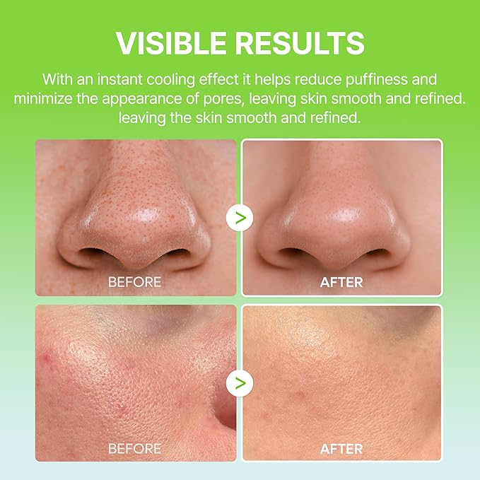 Dr.Melaxin Cactox Pore Relief Multi Balm Stick – Zinc PCA & ADENOSINE Cooling & De-Puffing Face Balm for Enlarged Pores & Puffy Skin, Pore Minimizing with Cactus Extract, Korean Skincare, 0.88 oz