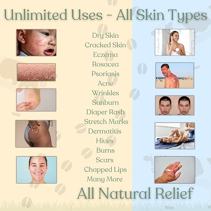 Beef Tallow for Skin | NAKED TALLOW BALM | 1 Ingredient - 100% Grass Fed Beef Tallow | Beef Tallow for Body & Face | Whipped & UNSCENTED for Sensititve Dry Skin, Babies, Eczema, Psoriasis