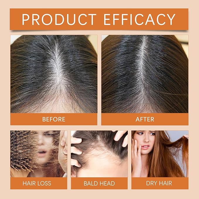 Hair Growth Ampoules with Turmeric Root Extract - Plant-Based Scalp Treatment for Thicker Hair, Strengthening Serum for Women & Men, Fragrance-Free Damaged Hair Care Solution,7pcs