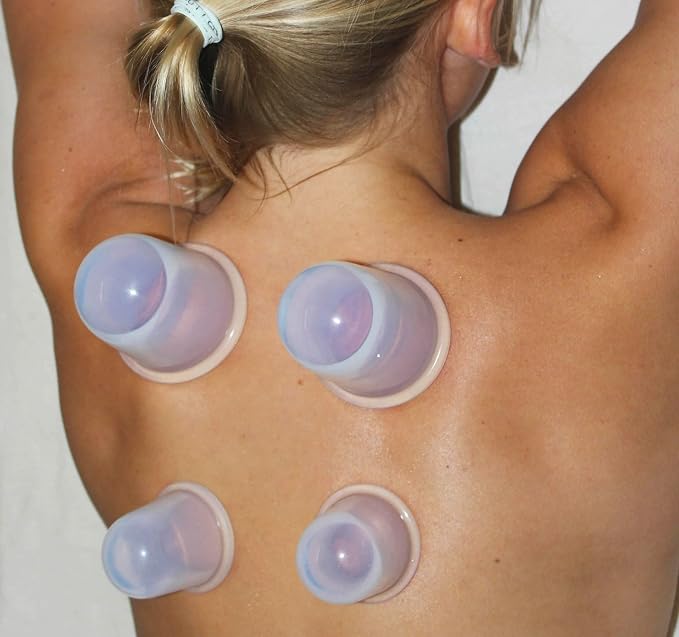 Cupping Kit for Massage Therapy, Set of 6 Professional Silicone Cups