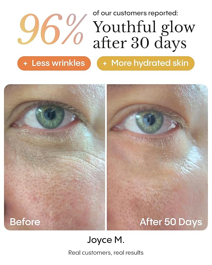 FRØYA Organics Hyper Potent Dark Circles & Eye Bag Balm | Nourishing Formula with Arctic Arnica, Pomegranate & Rosehip | Water-Free Beeswax Treatment for Smoother, Refreshed Eyes | 15ml