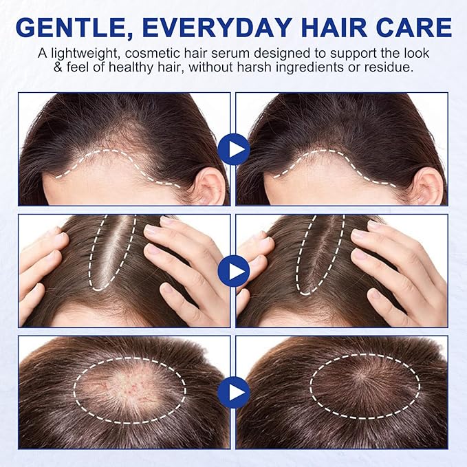 Hair Growth Serum Roll On, Hair Growth Serum Rosemary Oil Helps Hair Growth for Men and Women, Support Scalp Health, Fast-Absorbing, Non-Greasy (30ml)