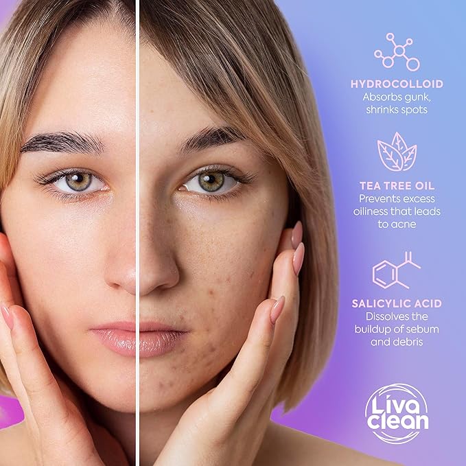 LivaClean 240 CT Cute Pimple Patches for Face w/Salicylic Acid & Tea Tree, Hydrocolloid Acne Patches Cute Flower Pimple Patch, Adorable Face Stickers, Zit Patch