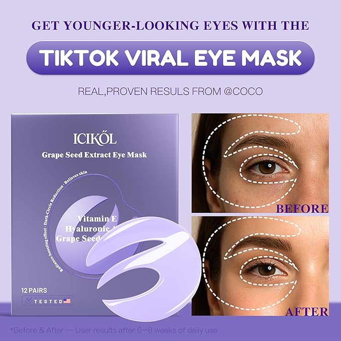 Under Eye Patches with Grape Seed Extract, Eye Patches for Puffy Eyes and Dark Circles, 360° Under Eye Mask for Radiance Boosting Effect, Dark‑Circle Reduction, Relieves Skin, 12 Pairs (Purple)