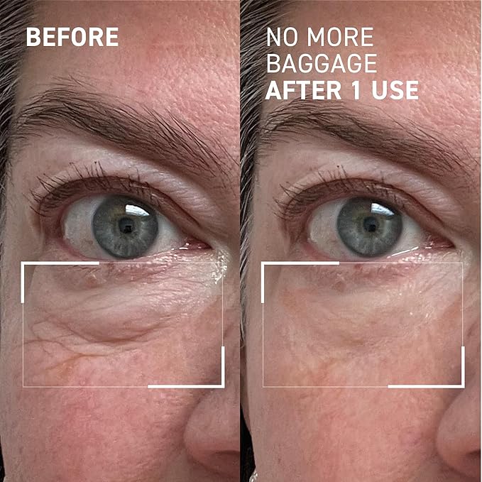 Dr. Brandt Needles No More, No More Baggage - Minimizes Under-Eye Bags, Puffiness & Dark Circles - 0.23 oz