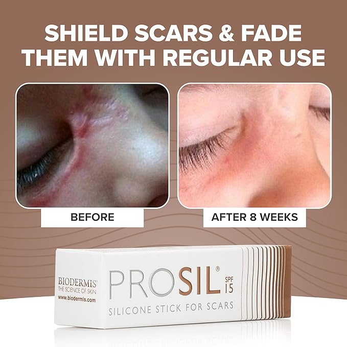 ProSil Silicone Scar Gel Stick with SPF 15 – Patented, Premium-Grade Scar Treatment in a Mess-Free, Compact, Glide-On Silicone Stick - Gentle Silicone Gel for Scars Suitable for Kids & Adults – 4.25g