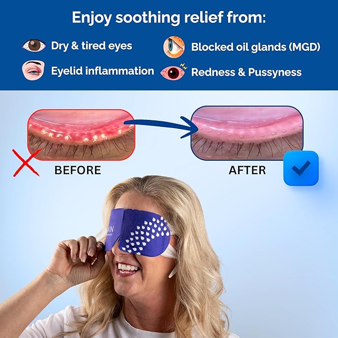 Rain Heated Eye Mask for Dry Eyes - Steam Eye Mask - Self Heating Warm Compress for Dry Eyes Relief, Stye Treatment, Moist Heat - Disposable, Unscented, No Microwave, Travel Ready, Spa (20 Masks)