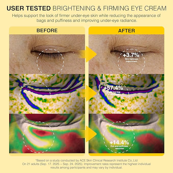 Be-Hope LUXURY Vegan Eye Lifting Roller Cream – Under Eye Brightening & Anti-Puffiness with Camellia Extract, Niacinamide & Adenosine – 30ml / 1.0 fl oz