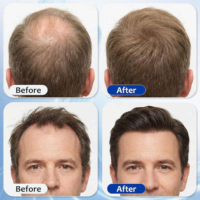Hair Growth Serum Roll On with 3% Rosemary,3% Batana Oil,2% Pea Extract,2% Ginger Root Oil,Stronger Root,stimulate follicle,Hair Thicker,Hair Loss Treatment,Hair Growth Serum(30ML/1.01FL.OZ)