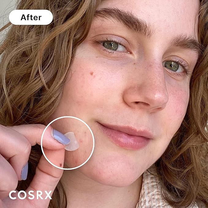 COSRX Acne Pimple Patch 5 Packs + 2% Alpha Arbutin Discoloration Care Serum