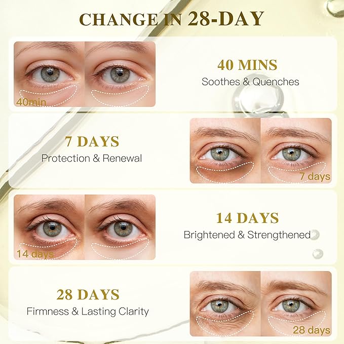 Turmeric Honey-C Radiance Under Eye Patches for Women - Hydrating & Oxidation Protection & Firms Skin Visibly Fades to Clear in 40 Mins, Fully Absorbed in 3Hrs. yellow, 12 Pairs.