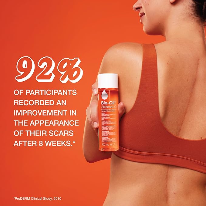 Bio-Oil Skincare Body Oil Serum for Scars and Stretch Marks, Face and Body Moisturizer with Vitamin E & A for Sensitive Dry Skin, Dermatologist Recommended, Non-Comedogenic, 2 oz, Case of 24