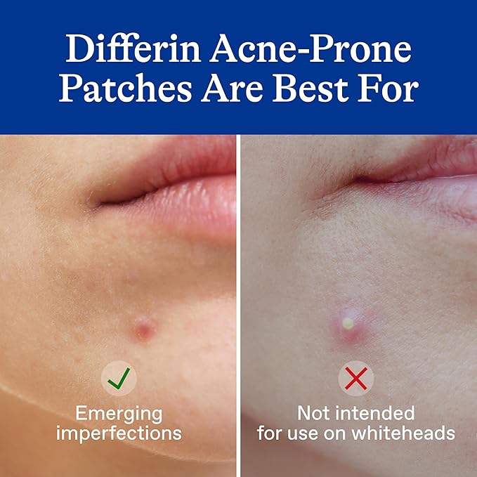 Differin Acne Patches,Pimple Patches for Acne Prone Skin,Formulated with Salicylic Acid and Centella,Fast Triple Action Power Patch for Day & Night,Dermatologist Tested,36 Count (Pack of 12)
