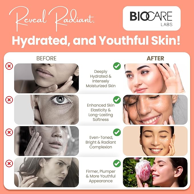Biocare Body Butter - Infused with Cocoa Butter & Shea Butter plus Alpha-Bioplex for Youthful-Looking, Radiant Complexion, Hydrated, Smoother, Firmer Skin - Without Paraben and Sulfate -16 Oz