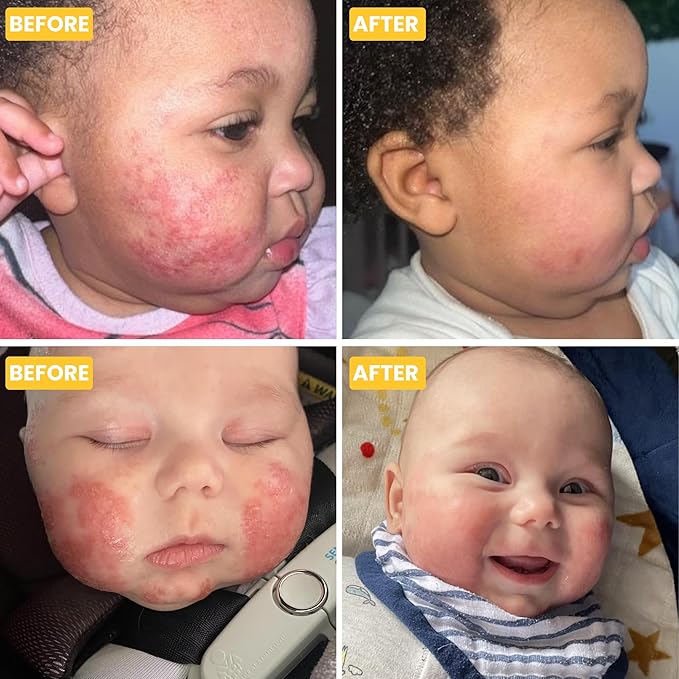 Grahams Natural Baby Eczema Cream Moisturizer for Newborn-12 Years | Rash, Redness, Dry Skin & Itch Relief | Colloidal Oatmeal & Shea Butter | Steroid-Free, Fragrance-Free for Sensitive Skin (75g)