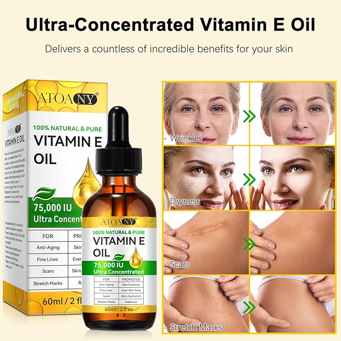 flasture Vitamin E Oil 75,000 IU – 100% Pure Natural Vitamin E for Skin, Face, Hair, Scars – Deep Moisturizing Body Oil for Dry Skin, Wrinkles – Cold-Pressed, Non-GMO,Skincare – 2 Fl Oz