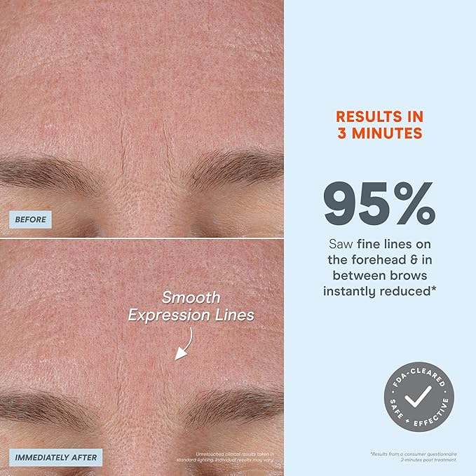 NuFACE FIX MicroWand Microcurrent Facial Device, FDA Cleared - Eyes, Lips & Lines Treatment with Serum Activator - Lip Plumper, Eye Depuffing Wand, Wrinkle & Smile Line Reducer, 3 On-The-Go Modes