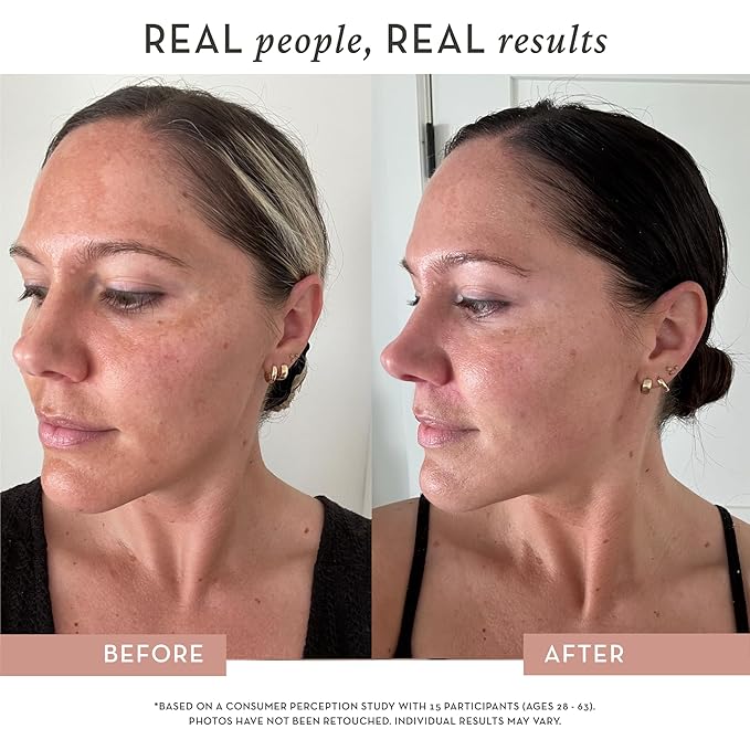 Dose of Glow Vitamin C Serum- Hydrating and Brightening Serum with Peptides, Hyaluronic Acid, Niacinamide and CoQ10. Firms Skin and Reduces Dark Spots and Fine Lines 1 oz (Limited Edition Glow Set)
