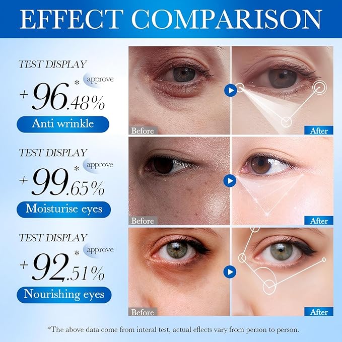 Retinol Eye Stick - Eye Cream for Dark Circles and Puffiness with Caffeine, Collagen & Hyaluronic Acid, Retinol Eye Cream Anti Aging, Reduces Fine Lines, Wrinkles & Under Eye Bags (1pcs)