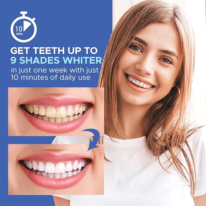 LUELLI Teeth Whitening Kit with LED Light, 35% Carbamide Peroxide Gel, Professional at-Home Whitening System for Sensitive Teeth, Removes Coffee, Wine, Smoking & Food Stains – Peppermint
