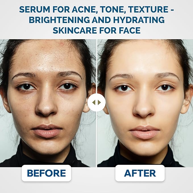 Renewa AgeDefy Niacinamide 5% Serum | Lightweight Hydrating Face Serum with Hyaluronic Acid and Antioxidants | Brightening, Smoothing and Skin-Barrier Support for Radiant-Looking Skin 17mL