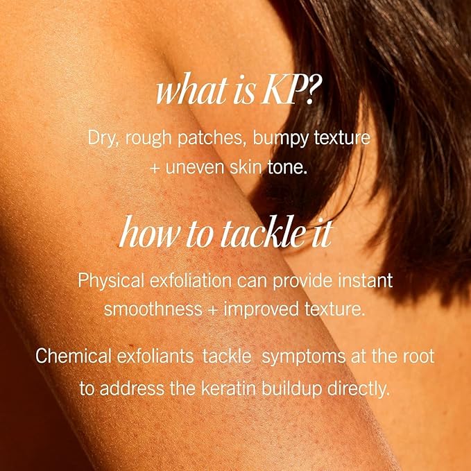 First Aid Beauty KP Bump Eraser Body Scrub with 10% AHA, Keratosis Pilaris Skin Exfoliator with Glycolic and Lactic acids, Helps Reduce Chicken Bumps, Safe for Sensitive Skin, 8 oz