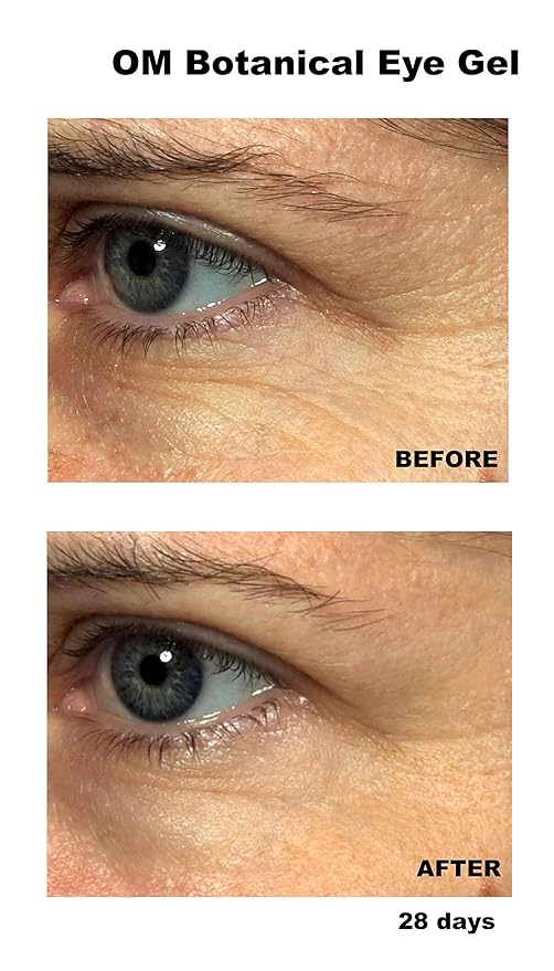 OM Botanical Peptide Eye Cream w/Vitamin C, Organic Argan Oil, Cucumber | Safe, Ultra Hydrating Rapid Wrinkle Repair Eye Gel For Fine Lines, Under Eye Bags and Dark Circles | Day & Night Cream