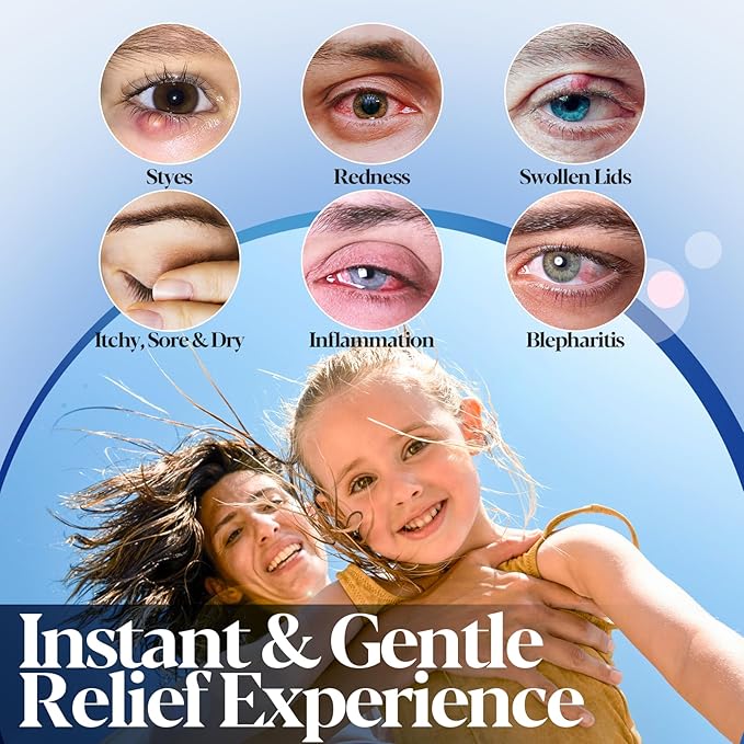 Stye Eye Treatment, Stye Relief Spray - 0.02% Hypochlorous Acid for Swelling, Redness, Eyelids Bump Removal with Natural Ingredients (3.4 Fl Oz (Pack of 1))
