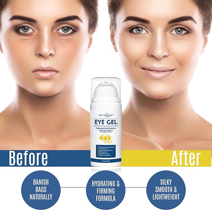 Eye Gel for Dry Eyes – Night Gel with Plant Stem Cells, Matrixyl 3000 & Peptides – Under Eye Gels for Dark Circles and Puffiness | Hydrates for a Smooth, Refreshed Look – 1 Fl Oz / 30 ml