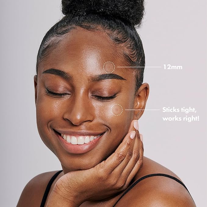 ACROPASS Trouble Care Microcone Acne Patch, Spot Care for Early Pimple and Zits, Hydrocolloid & Niacinamide for Blemishes (Regular Size - 6count)