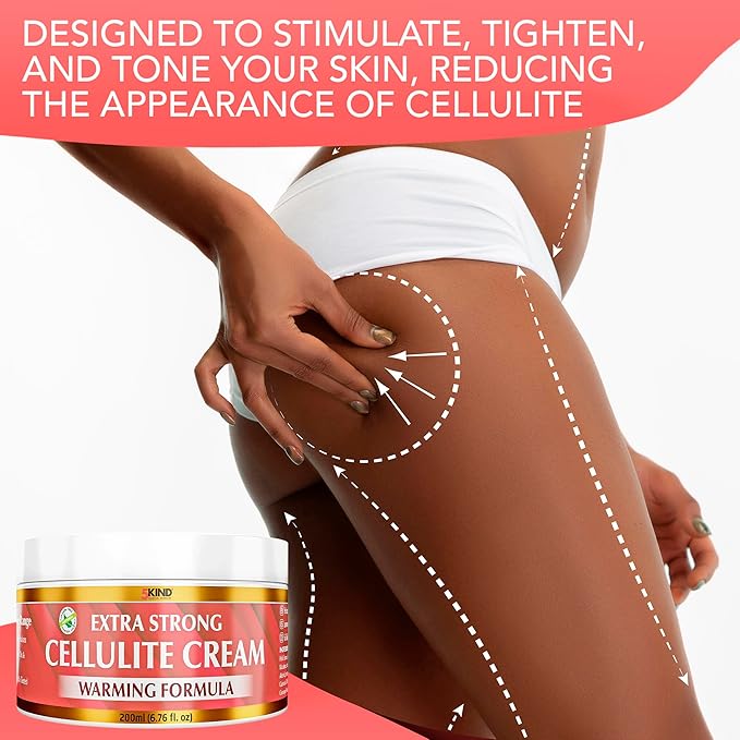 5Kind Extra Strong Anti Cellulite Cream 6.76 Fl Oz - Natural Warming Formula Cellulite Remover for Legs - Body Firming and Tightening Cream - Firming Cream for Cellulite