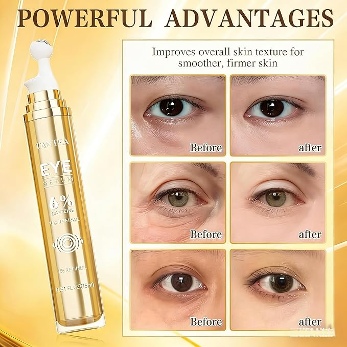 6% Caffeine Eye Cream for Dark Circles & Puffiness, 1% Retinol Eye Serum for Under Eyes Bags, Anti-Aging Eyes Cream for Men and Women (0.52 Fl)