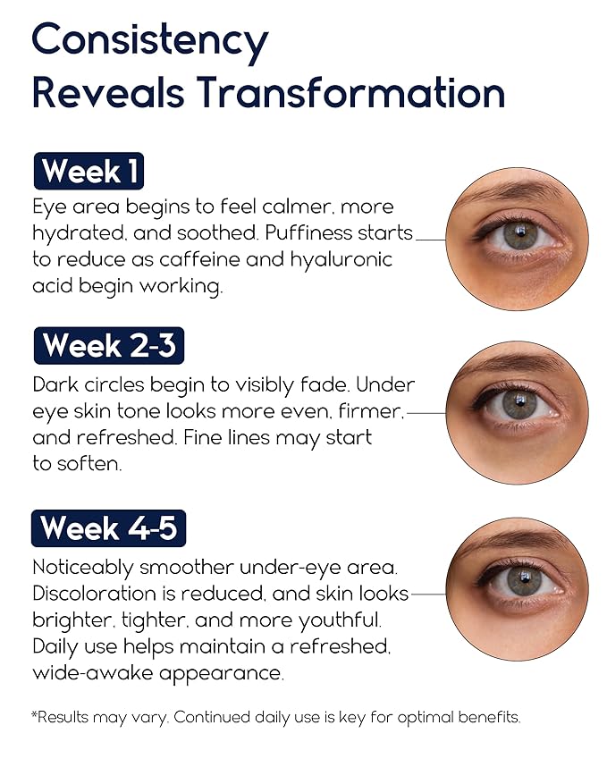 Under Eye Cream for Puffiness and Bags Under Eyes - Eye Bags Treatment for Men & Women - Anti Wrinkle Cream for Dark Circles, Baggy Eyes Treatment for Women with Retinol, Hyaluronic Acid & Caffeine