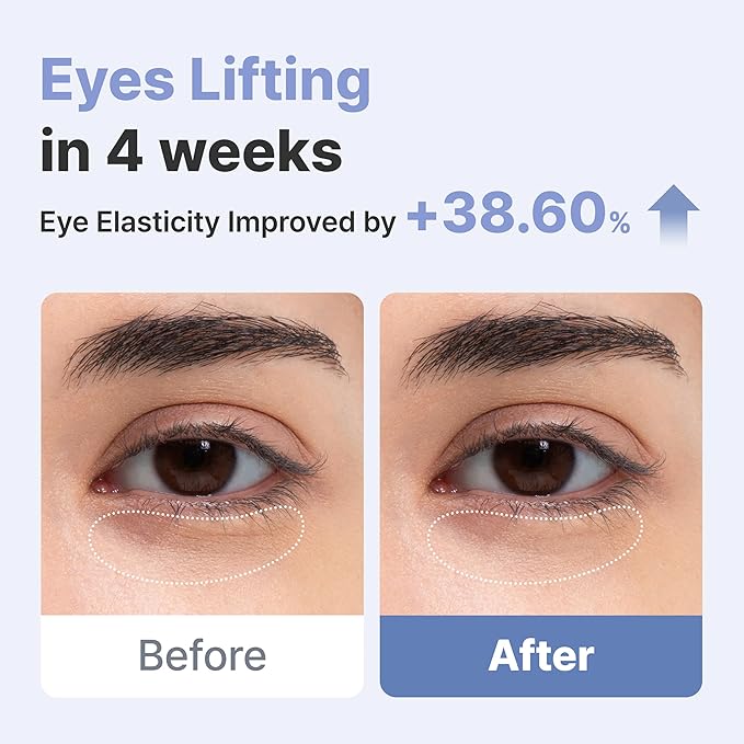 AROCELL Botulcare Wrinkle Solution Vibrating Eye Cream | Korean Under Eye Cream | Collagen & Galvanic Care, Hydrating, Moisturizing & Elasticity Boosting | Gentle Daily Eye Care | 0.5 fl oz