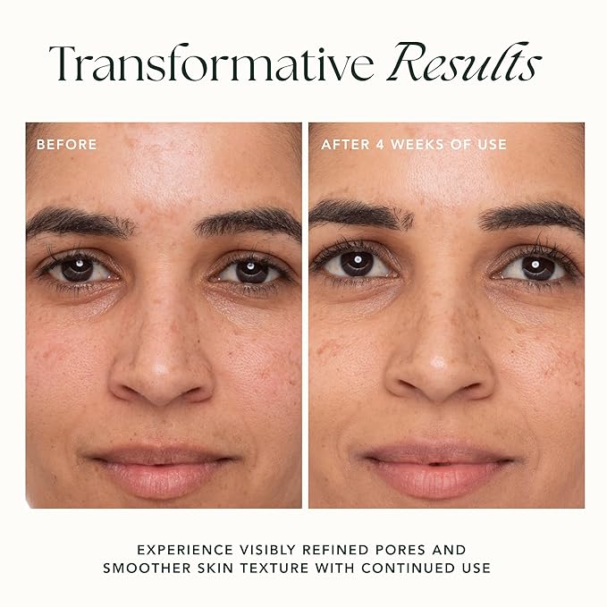 RANAVAT Refining Lotus Gel Cream - Hydrating Gel Moisturizer & Pore Minimizer – Improves Radiance & Texture with Hyaluronic Acid & Floral Ketoacids (1.7 oz)