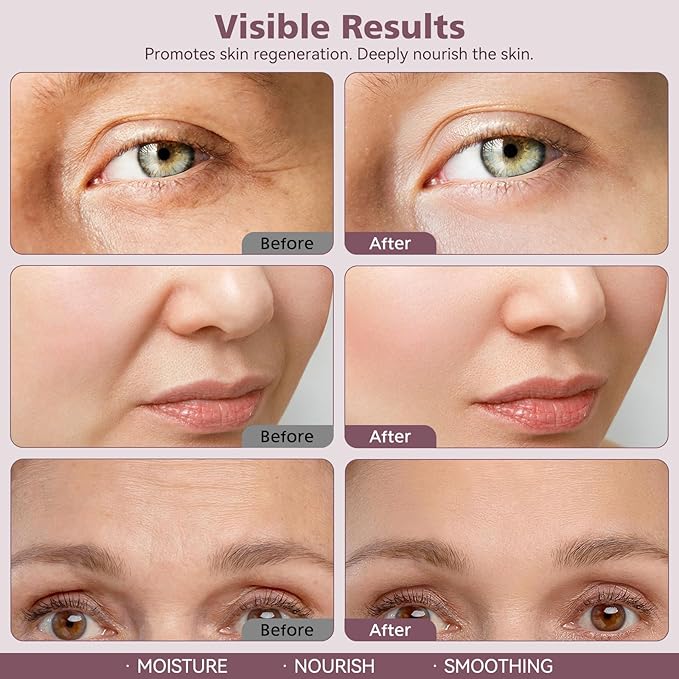 Wrinkle Bounce Multi Balm, Calcium Multi Balm Stick, Moisturizing Stick, Anti-aging, Hydrating, Skin Firming, for Eyes, Face, Neck, 10g/0.35oz