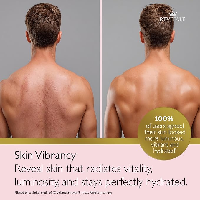 REVITALE Advanced Salicylic Acid Cream for Face & Body 80g – Helps Smooth & Soften Skin Texture. For Rough, Bumpy & Blemish-Prone Skin