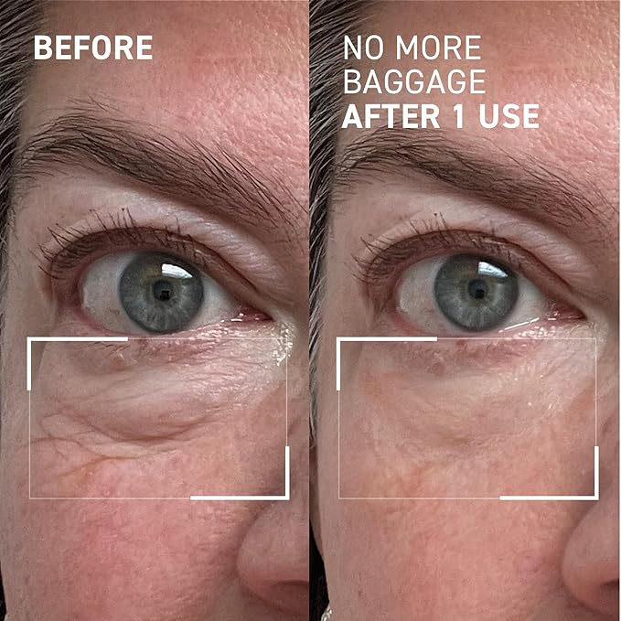 Dr. Brandt Needles No More, No More Baggage - 0.23 oz, Pack of 2 - Minimizes Under-Eye Bags, Puffiness & Dark Circles