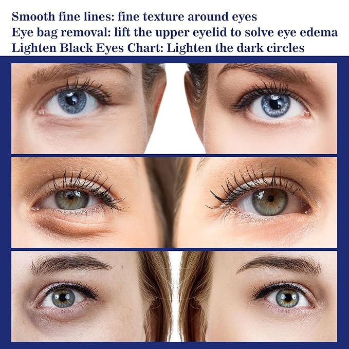 Active Eye Cream for Dark Circles & Puffiness - Anti-Aging Eye Cream with Acetyl Hexapeptide-8 & Caffeine, Reduces Eye Bags, Wrinkles & Fine Lines, Hydrating & Firming Eye Treatment