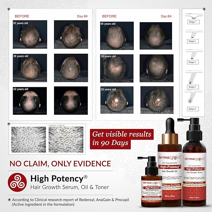 High Potency® Hair Growth Serum – Hair Defence Pro Formula | 24% Clinically Proven Actives with 5% Anagain, 5% Baicapil, 4% Procapil, Redensyl, 2% Capilia Longa, Niacinamide & Copper Peptide 30 mL