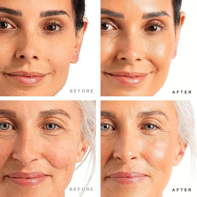 Tree of Life Beauty Facial Skin Care Set, Brightening, Firming, Hydrating, Dry Face, Dermatologist Tested - Vitamin C Serum (Brightens) + Retinol Serum (Smooths) - Skin Care Kit, 2 count of 1 Fl Oz