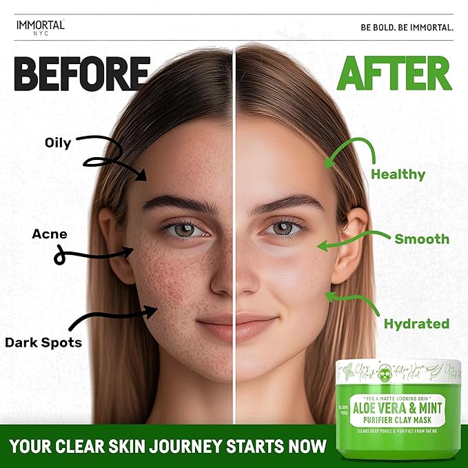 Immortal NYC - Aloe Vera & Mint Purifier Clay Mask – Face Mask for Matte Look Skin, Oil Control, Deep Cleansing & Refreshing Skincare. Great Gifts For Women & Men – 10 oz